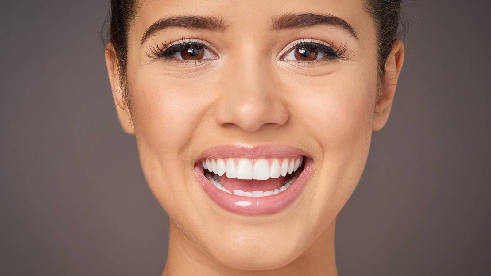Smile Makeover
